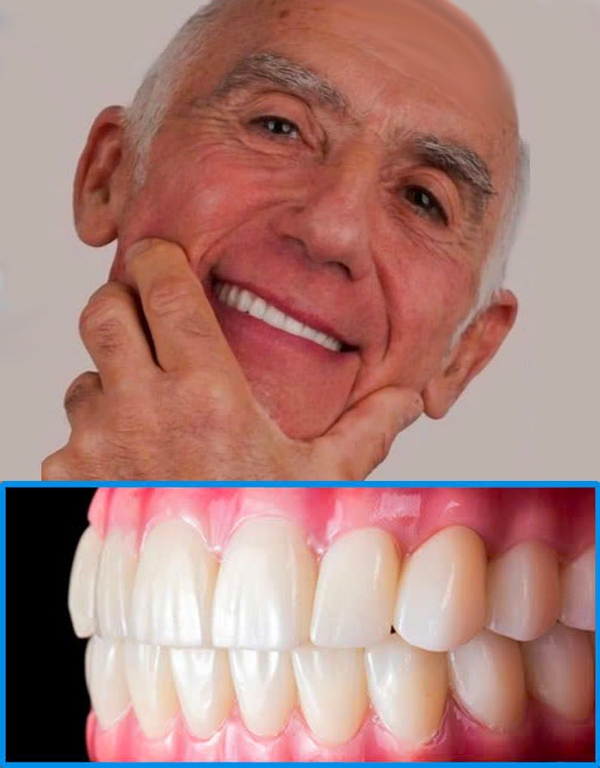 After All-on-4 full arch dental implant restoration — patient from Melbourne